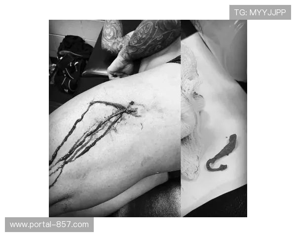 科尔特斯-阿科斯塔遭眼部重创后逆转KO 赛后伤情严重 科尔特斯-阿科斯塔遭眼部重创后逆转KO 赛后伤情严重